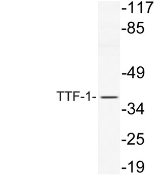 TTF-1 rabbit pAb Antibody