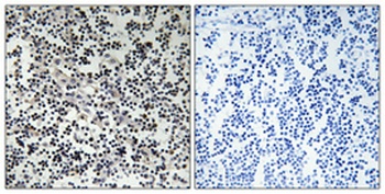Thymidine Kinase rabbit pAb Antibody