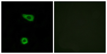 TNFα-IP 2 rabbit pAb Antibody