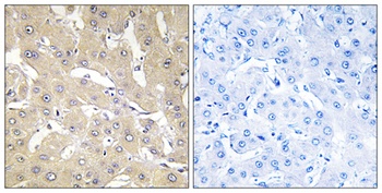 TNFα-IP 2 rabbit pAb Antibody