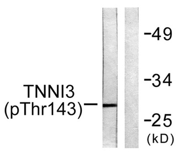 Troponin I-C (phospho Thr142) rabbit pAb Antibody