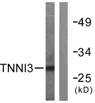 Troponin I-C rabbit pAb Antibody