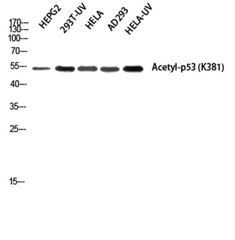 p53 (Acetyl Lys381) rabbit pAb Antibody