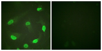 p53 (Acetyl Lys381) rabbit pAb Antibody