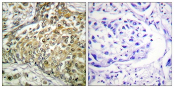 p53 (Acetyl Lys381) rabbit pAb Antibody