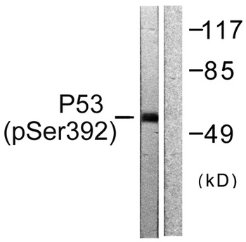 p53 (phospho Ser392) rabbit pAb