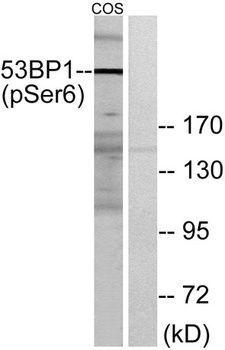 53BP1 (phospho Ser6) rabbit pAb