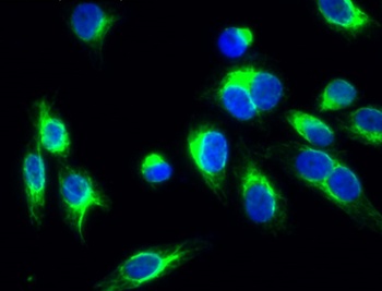TPH1 rabbit pAb Antibody