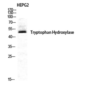 TPH1 rabbit pAb Antibody