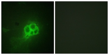 TPH1 rabbit pAb Antibody
