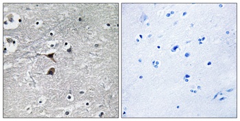 TPH1 rabbit pAb Antibody