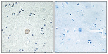 C3aR rabbit pAb Antibody
