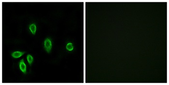 TRH-R1 rabbit pAb Antibody