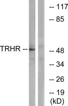TRH-R1 rabbit pAb Antibody