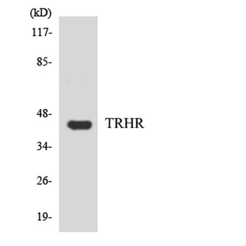 TRH-R1 rabbit pAb Antibody