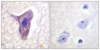 CD88 (phospho Ser338) rabbit pAb Antibody