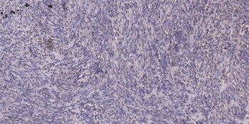 THP rabbit pAb Antibody