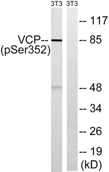 VCP (phospho Ser352) rabbit pAb