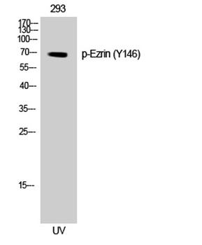 Ezrin (phospho Tyr146) rabbit pAb Antibody