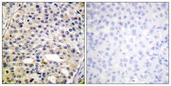 Vimentin (phospho Ser56) rabbit pAb