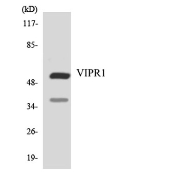VPAC1 rabbit pAb Antibody