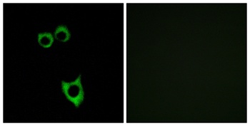 VPAC2 rabbit pAb Antibody