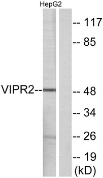 VPAC2 rabbit pAb Antibody