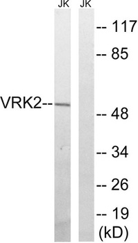VRK2 rabbit pAb Antibody