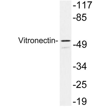 Vitronectin rabbit pAb Antibody