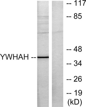 14-3-3 η rabbit pAb Antibody