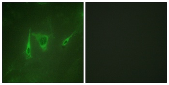 14-3-3 ζ/δ rabbit pAb Antibody