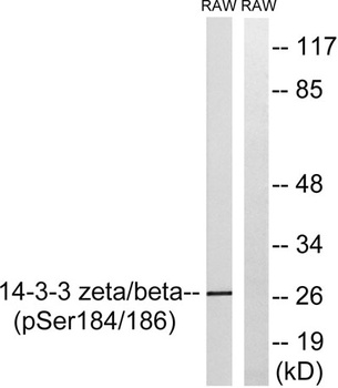 14-3-3 β/ζ (phospho Ser184/186) rabbit pAb Antibody