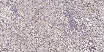14-3-3 β/ζ rabbit pAb Antibody