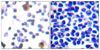 ZAP-70 (phospho Tyr315) rabbit pAb