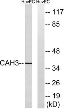 CA III rabbit pAb Antibody