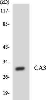 CA III rabbit pAb Antibody