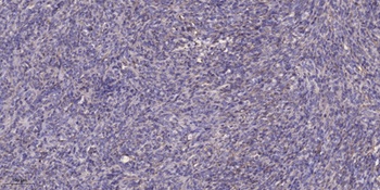 CA VIII rabbit pAb Antibody