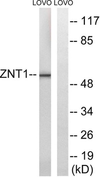 ZnT-1 rabbit pAb Antibody