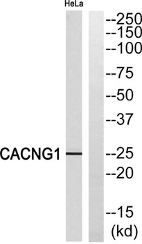 L-type Ca++ CP γ1 rabbit pAb Antibody