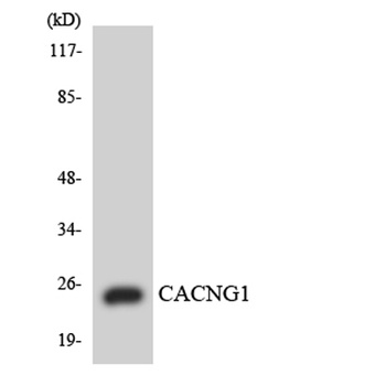 L-type Ca++ CP γ1 rabbit pAb Antibody