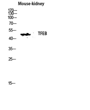 TFEB rabbit pAb Antibody
