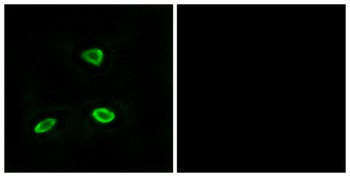 Olfactory receptor 52N1 rabbit pAb Antibody