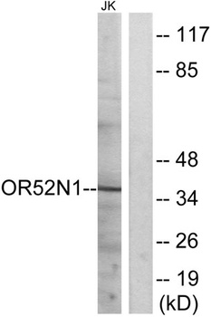 Olfactory receptor 52N1 rabbit pAb Antibody