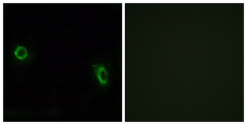 Olfactory receptor 6J1 rabbit pAb Antibody