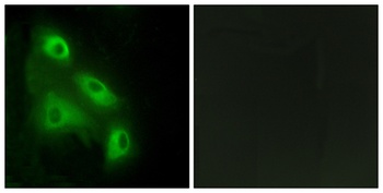 Eps8L3 rabbit pAb Antibody