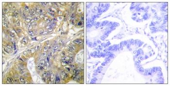Eps8L3 rabbit pAb Antibody