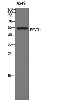 GPR172A rabbit pAb Antibody