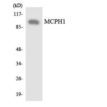 Microcephalin rabbit pAb Antibody
