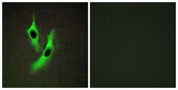STAMP2 rabbit pAb Antibody