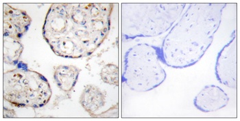STAMP2 rabbit pAb Antibody
